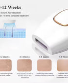 Laser Hair Removal Machine PRO